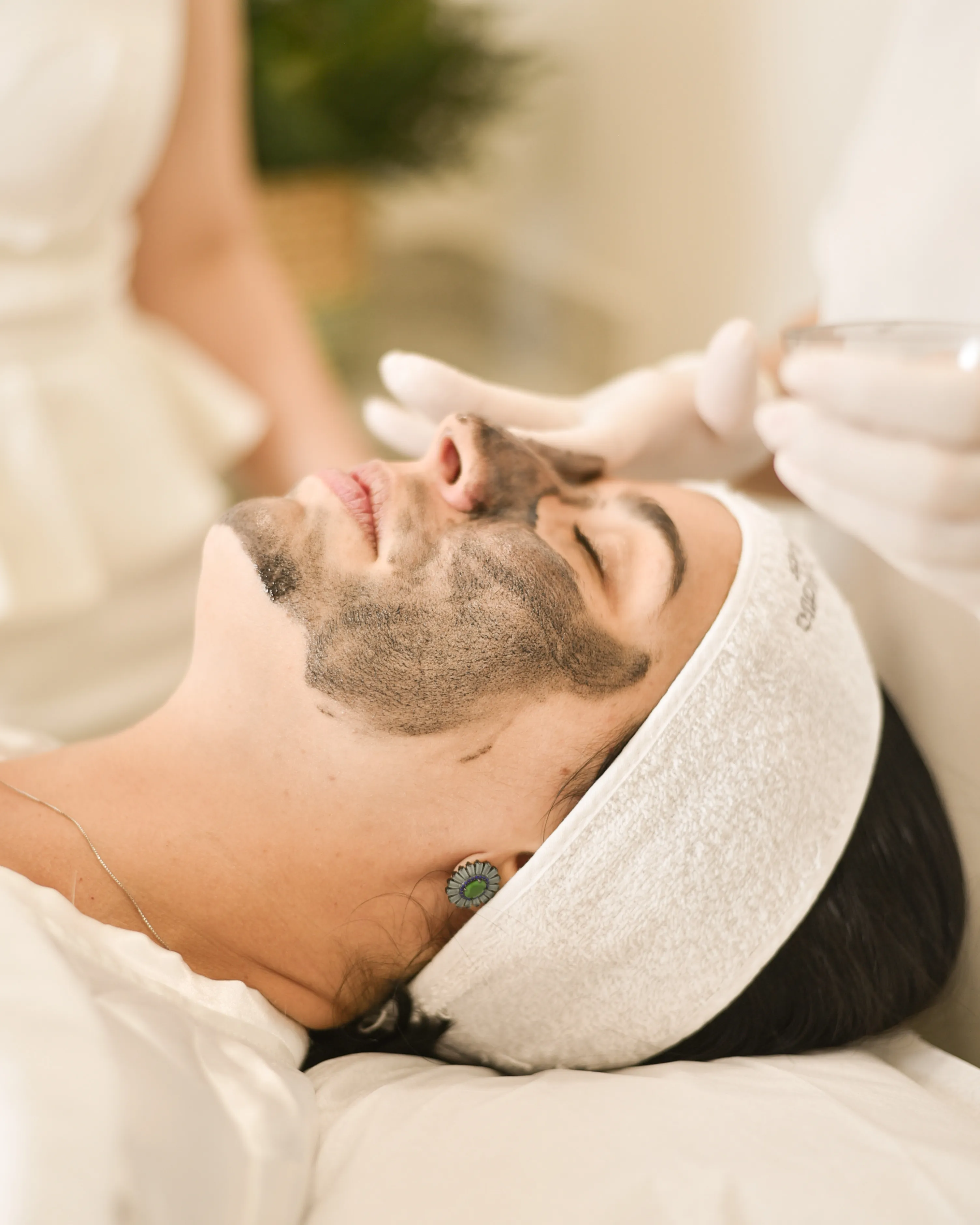 Tratamento para Manchas e Melasma - Hiperpigmentação e manchas escuras na pele do rosto